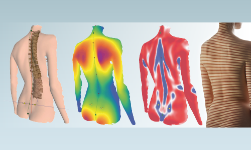 3D Surface and Spine