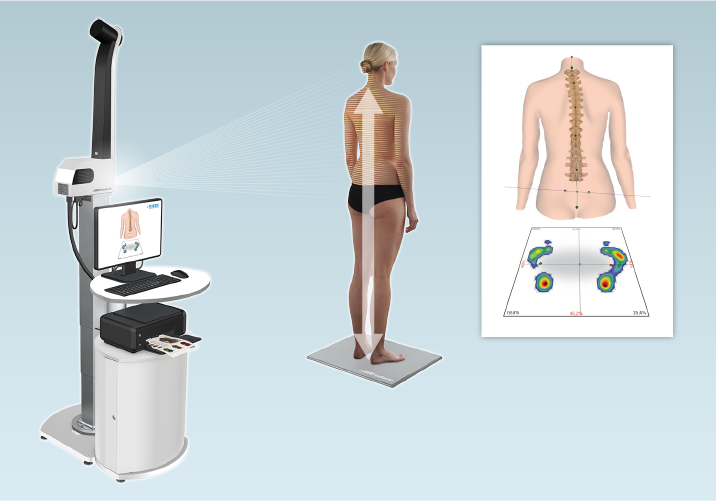 DIERS 4D posture Lab: Posture Analysis from Head to Toe