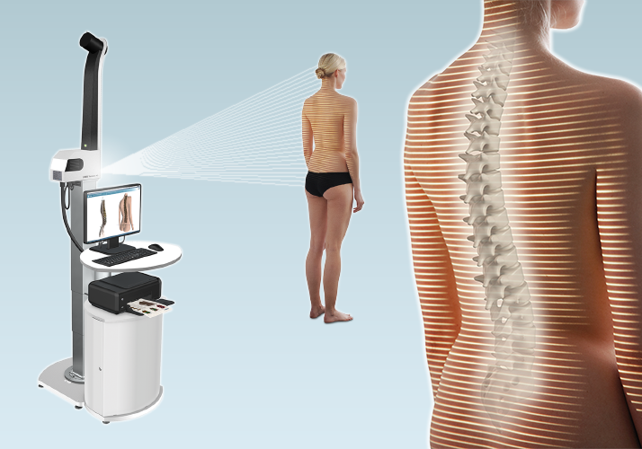 Representación de la columna vertebral con evidencia de la columna