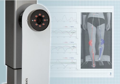 DIERS leg axis (posterior): Video Gait Analyis