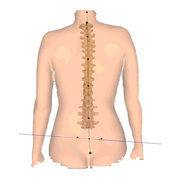 3D Spine Reconstruction