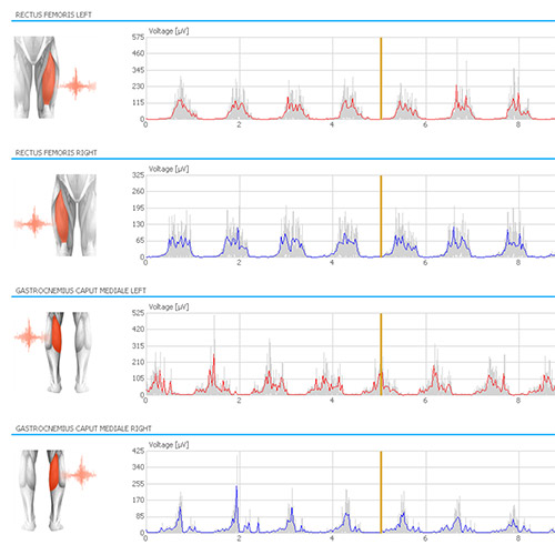 EMG (Cycling)