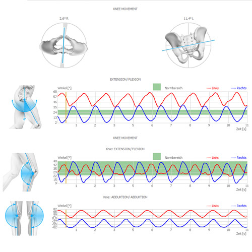 Inertial Measurement (Cycling)