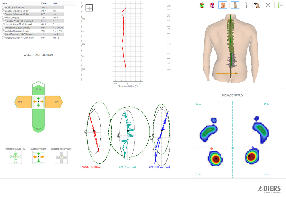 DIERS posture lab: spine analysis + foot pressure measurement