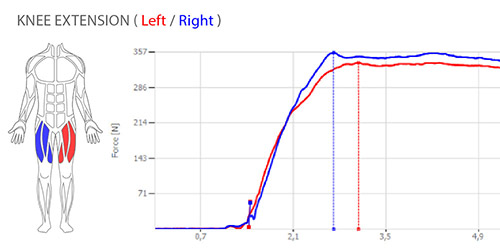 DIERS myoline: Knee Extension (Left-Right)