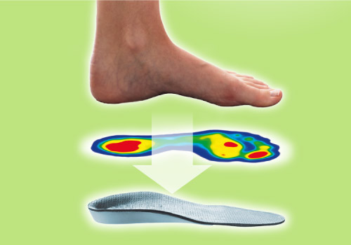 DIERS foot balance: Individual Insole Treatment