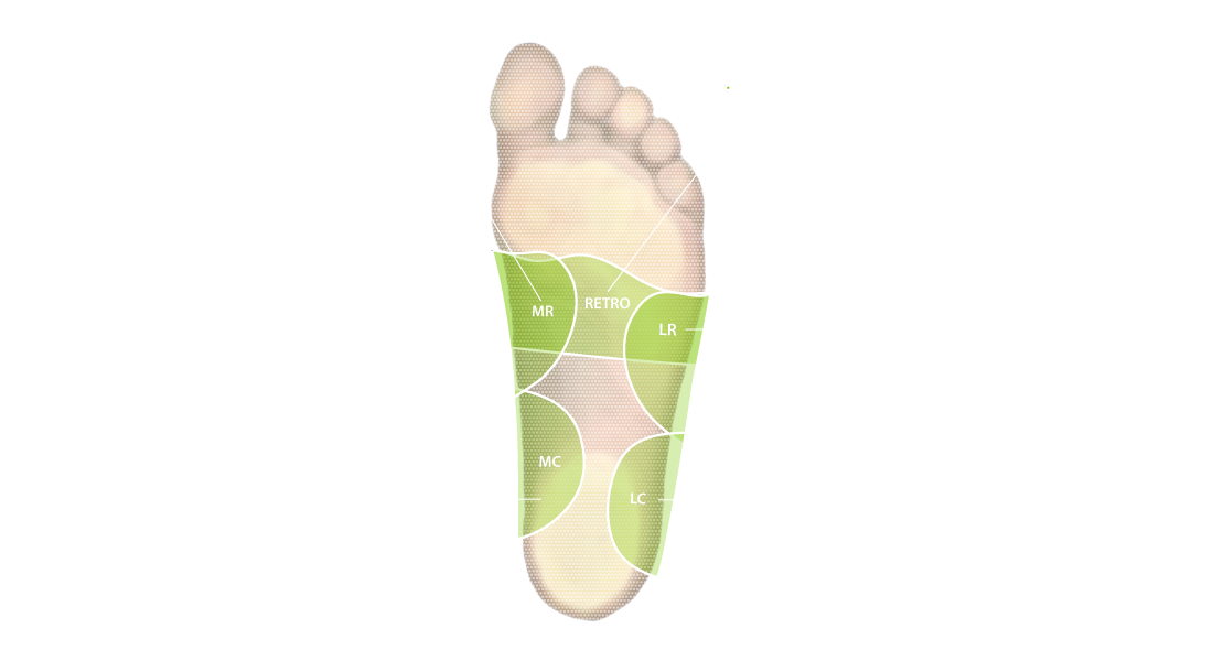 DIERS posture balance: Sensomotorische haltungskorrigierende Einlagen (Pelotten)