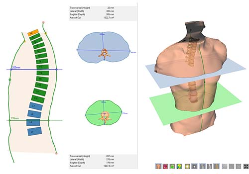 DICAM 3: torso scan