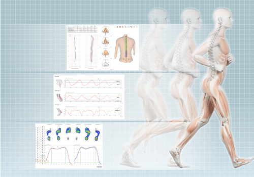 DIERS 4DmotionLab (high-performance): Motion Analysis while Running